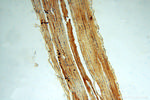 KIF1B Antibody in Immunohistochemistry (Paraffin) (IHC (P))