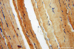 KIF1B Antibody in Immunohistochemistry (Paraffin) (IHC (P))