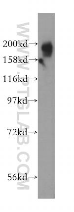 KIF1B Antibody in Western Blot (WB)