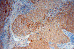 Adenylosuccinate lyase Antibody in Immunohistochemistry (Paraffin) (IHC (P))