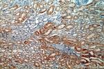 MLYCD Antibody in Immunohistochemistry (Paraffin) (IHC (P))