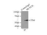 MLYCD Antibody in Immunoprecipitation (IP)