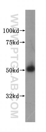 MLYCD Antibody in Western Blot (WB)