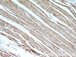 MLYCD Antibody in Immunohistochemistry (Paraffin) (IHC (P))