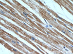 MLYCD Antibody in Immunohistochemistry (Paraffin) (IHC (P))