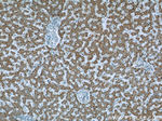 MLYCD Antibody in Immunohistochemistry (Paraffin) (IHC (P))