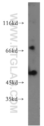 MLYCD Antibody in Western Blot (WB)