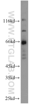 MLYCD Antibody in Western Blot (WB)