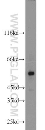 MLYCD Antibody in Western Blot (WB)