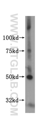 MLYCD Antibody in Western Blot (WB)