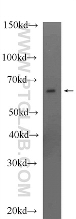 MLYCD Antibody in Western Blot (WB)