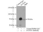 INTS10 Antibody in Immunoprecipitation (IP)