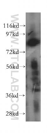 INTS10 Antibody in Western Blot (WB)