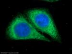 VAPA Antibody in Immunocytochemistry (ICC/IF)