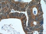 VAPA Antibody in Immunohistochemistry (Paraffin) (IHC (P))