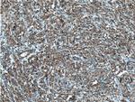 DHRS4 Antibody in Immunohistochemistry (Paraffin) (IHC (P))