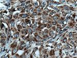 DHRS4 Antibody in Immunohistochemistry (Paraffin) (IHC (P))