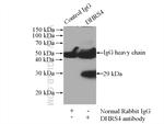 DHRS4 Antibody in Immunoprecipitation (IP)