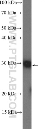 DHRS4 Antibody in Western Blot (WB)