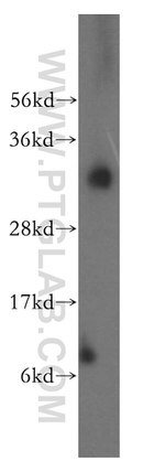 ATP6V1E1 Antibody in Western Blot (WB)