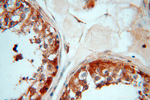 ATP6V1E1 Antibody in Immunohistochemistry (Paraffin) (IHC (P))