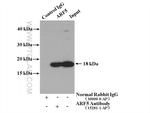 ARF5 Antibody in Immunoprecipitation (IP)