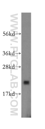 ARF5 Antibody in Western Blot (WB)