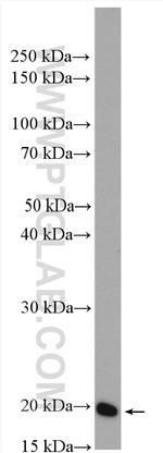 ARF5 Antibody in Western Blot (WB)