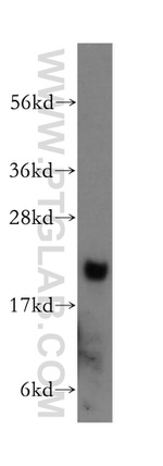 ARF5 Antibody in Western Blot (WB)