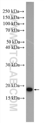 ARF5 Antibody in Western Blot (WB)