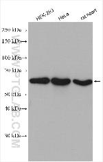 HSP60 Antibody in Western Blot (WB)