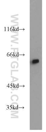 HSP60 Antibody in Western Blot (WB)