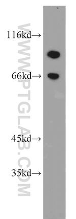 HJURP Antibody in Western Blot (WB)