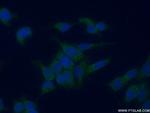 GALK1 Antibody in Immunocytochemistry (ICC/IF)