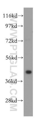 GALK1 Antibody in Western Blot (WB)