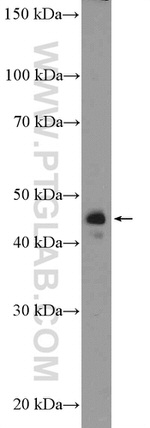 GALK1 Antibody in Western Blot (WB)