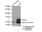 SC65 Antibody in Immunoprecipitation (IP)