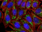 ADRP/Perilipin 2 Antibody in Immunocytochemistry (ICC/IF)