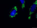 ADRP/Perilipin 2 Antibody in Immunocytochemistry (ICC/IF)