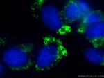 ADRP/Perilipin 2 Antibody in Immunocytochemistry (ICC/IF)