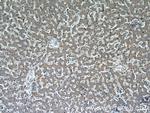 ADRP/Perilipin 2 Antibody in Immunohistochemistry (Paraffin) (IHC (P))