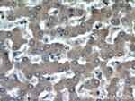 ADRP/Perilipin 2 Antibody in Immunohistochemistry (Paraffin) (IHC (P))