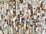 ADRP/Perilipin 2 Antibody in Immunohistochemistry (Paraffin) (IHC (P))