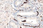 ADRP/Perilipin 2 Antibody in Immunohistochemistry (Paraffin) (IHC (P))