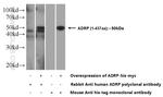 ADRP/Perilipin 2 Antibody in Western Blot (WB)