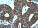 ADRP/Perilipin 2 Antibody in Immunohistochemistry (Paraffin) (IHC (P))