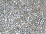 ADRP/Perilipin 2 Antibody in Immunohistochemistry (Paraffin) (IHC (P))