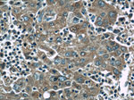 ADRP/Perilipin 2 Antibody in Immunohistochemistry (Paraffin) (IHC (P))