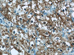 ADRP/Perilipin 2 Antibody in Immunohistochemistry (Paraffin) (IHC (P))