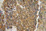 CARS Antibody in Immunohistochemistry (Paraffin) (IHC (P))